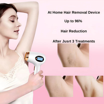 IPL Hair Removal Device with 999,900 Flashes